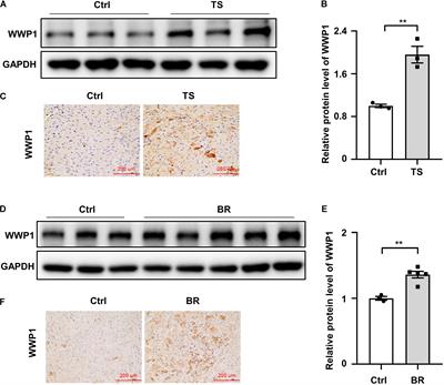 WWP1 Deficiency Alleviates Cardiac Remodeling Induced by Simulated Microgravity